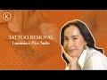 Tattoo Removal