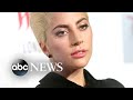 Dr. Luke subpoenas Lady Gaga in defamation suit against Kesha