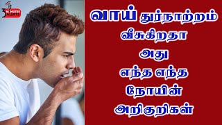 வாய் நாற்றம் வீசுகிறதா அது எந்த எந்த நோயின் அறிகுறிகள் /3 MINUTES ALERTS /HEALTH TIPS/MOUTH HEALTH