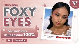 Well Clinic ดึงหางตาเฉี่ยว ปรับลุคสายฝอ : เนย l Foxy eyes Ep.3