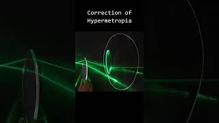 hypermetropia