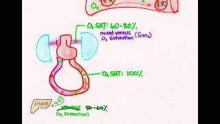 Circulatory Shock 03 More Treatment