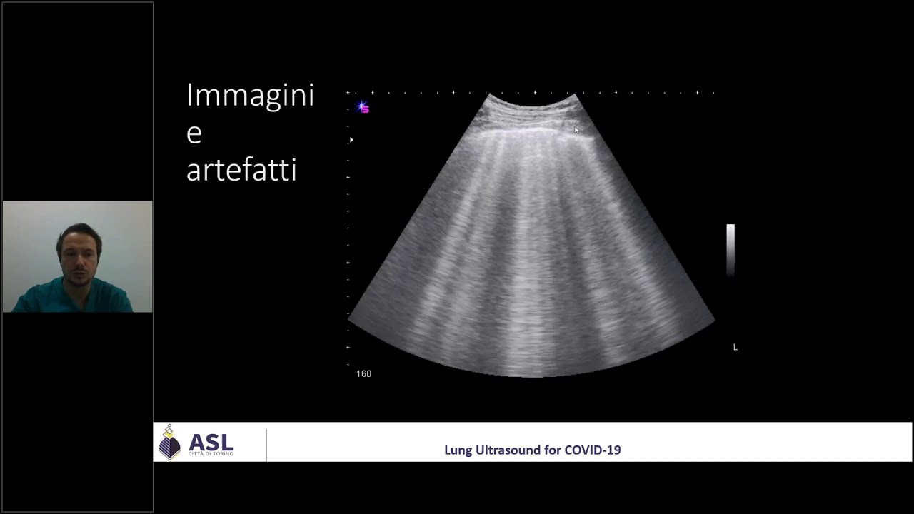 Ecografia Polmonare Per Le USCA 3 - Segni Di Base - YouTube