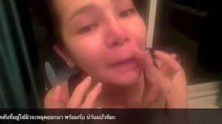 ครีมบัวหิมะ kefirbeautycollection