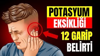 12 Garip İşaret Vücudunuzun POTASYUMA İHTİYACI VAR