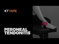 peroneal tendonitis