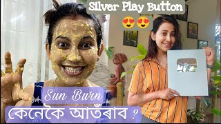 Removing Sun Burn | Silver Play Button | Barsha rani Bishaya