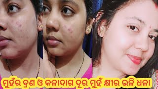 ମୁହଁର ବ୍ରଣ ଓ କଳାଦାଗ ଦୂର ମୁହଁ କ୍ଷୀର ଭଳି ଧଳା || ଗୋରା ଓ ସୁନ୍ଦର ହେବାର ଉପାୟ || ଗୋଟେ ଥର ଲଗେଇଦେଖନ୍ତୁ #odia