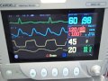 Anesthetic Monitoring Video