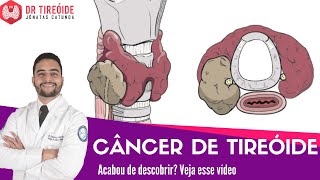 Câncer de Tireóide - Vídeo para quem acabou de descobrir! | Dr Jônatas Catunda