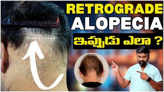 #AskDrJohnWatts | RETROGRADE ALOPECIA ఇప్పుడు ఎలా ? | Hair Specialist Explains