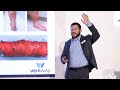 Jordan Pollack, VeinWay - Venous Recanalization, Controlled | LSI Europe '24