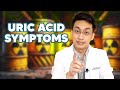 Askdocdex: URIC ACID Symptoms | Dr. Dex Macalintal