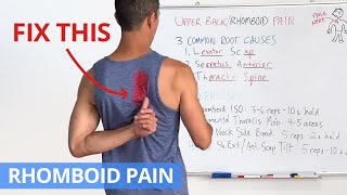 How to Fix Upper Back / Rhomboid Pain for GOOD (4 Effective Exercises)