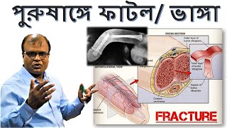 পুরুষাঙ্গে ফাটল / ভাঙ্গা | Penile Fracture | Dr. Abdul Mannan