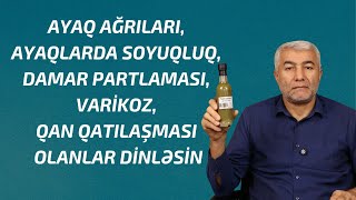 Damar problemləri, Varikozlar, Ayaqlarda damar partlaması olanlar üçün | Fizuli Hüseynov