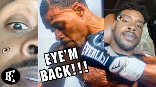 Errol Spence Eye FIRST EVER LOOK Since Surgery - Spence LEAKED Vid