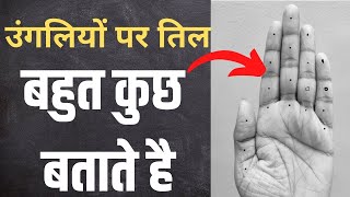 उंगलियों पर तिल बहुत कुछ बताते है  | mole on hand palmistry |  moles in palmistry