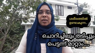 ചൊറിച്ചിൽ മാറ്റാനുള്ള ഒറ്റമൂലി/How to remove itching?/Home remedies/health tips malayalm