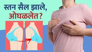 सैल स्तनासाठी करा हा उपाय | How to Tighten Sagging Breasts | Get Rid of Saggy Breasts | Lokmat Sakhi