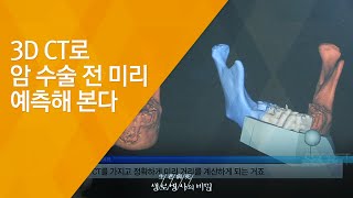 3D CT로 암 수술 전 미리 예측해 본다 - (20141112_524회 방송)_의료 분야에 부는 ‘3D 프린터’ 바람