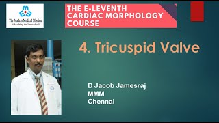 11thCM MMM 4  Tricuspid Valve Dr S K Nair