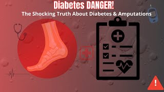 Diabetes \u0026 Amputations: The Alarming Link You Need to Know About!