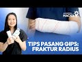 Tips Pasang Gips: Fraktur Radius