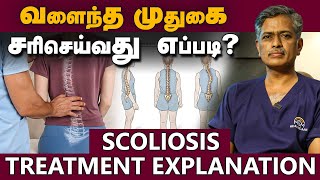 Scoliosis Treatment explanation வளைந்த முதுகை சரிசெய்வது எப்படி | Scoliosis Treatment explanation