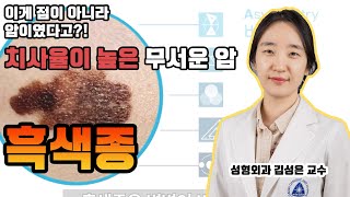 점인줄 알았는데.. 흑색종? 증상이 나타났을 때는 늦은 경우가 많아 예방 및 조기 발견이 중요합니다!(feat. 성형외과 김성은 교수)[대구가톨릭대병원]