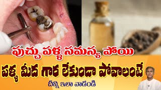 How to Reduce Dental Cavity? | Pippi Pannu Remedy | White Teeth | Enamel | Dr.Manthena's Health Tips