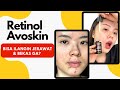 Review Retinol Avoskin Setelah Pakai 3 Bulan (Beneran Hilangin Jerawat & Bekas Ga?)