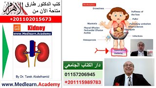 Nephrotic Syndrome    #cme #internal_medicine  #usmle #medical #محاضرات_باطنة