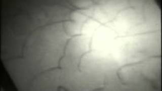 Dislocation Movement