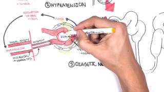 Nephrology - Chronic Kidney Disease Pathophysiology