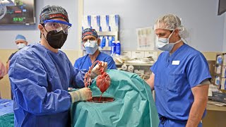 First Ever Pig to Human Heart Transplant (Official Video) - University of Maryland Medicine