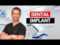 Single Tooth Implant