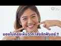 สำรวจเทคโนโลยีการจัดฟันใส kase aligner คืออะไร จัดฟันใส จัดฟันแบบใส