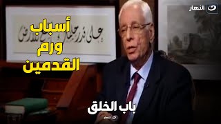 دكتور حسام موافي : القلب والكلى والكبد والغدة الدرقية من أهم أسباب ورم القدمين  !!