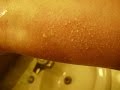 Horsehair Nematomoropha Rash Morgellans Horsehair Nematomoropha Rash Morgellans