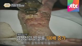 착한 암이 아니다! 암 발생 1위 갑상선암!! 달콤한 정보쇼 꿀단지 21회