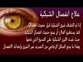 علامات على أنك لك انفصال الشبكية