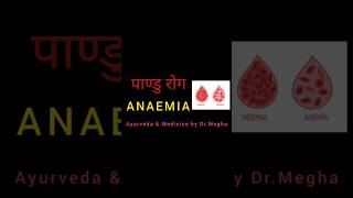 पाण्डु चिकित्सा(ANEMIA TREATMENT) #ayurveda #ayurvedicmedicine #bams #medical#pharmacy #kayachikitsa