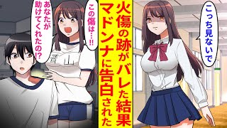 【漫画】昔少女を火事から救った火傷の跡がある俺→ある日体育の授業でマドンナに跡がバレると「あなただったの!?ずっと探してたの…」俺に塩対応だったのに甘々になって告白された【恋愛マンガ動画】