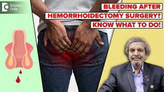 BLEEDING after PILES/HEMORRHOID SURGERY| Hemorrhoidectomy Recovery-Dr.Rajasekhar MR| Doctors' Circle