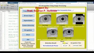 Iris Recognition Using Image Processing Matlab Project Source Code || Final Year Project