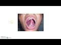 premalignant lesions of oral cavity for medical students