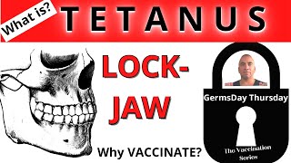 What is TETANUS? | LOCKJAW? | Why vaccinate against Tetanus?