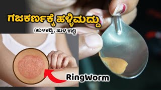 ತುಂಬಾನೇ ಪರಿಣಾಮಕಾರಿಯಾಗಿದೆ ಈ ಹಳ್ಳಿಮದ್ದು | Ringworm Home Treatment Medicine in Kannada | Food Media