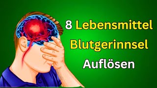 Die 8 besten Lebensmittel zur natürlichen Auflösung von Blutgerinnseln  Gesunde Ernährungstipps